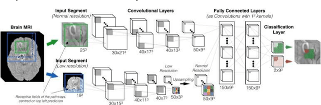 Figure 1 for Investigating certain choices of CNN configurations for brain lesion segmentation