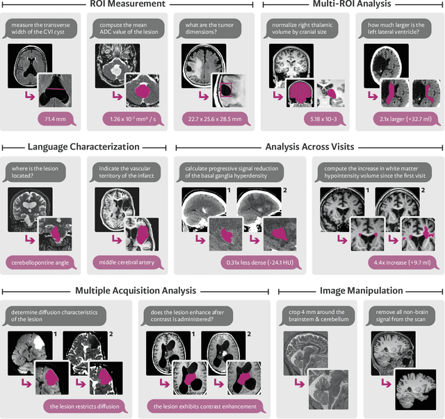 Figure 1 for VoxelPrompt: A Vision-Language Agent for Grounded Medical Image Analysis