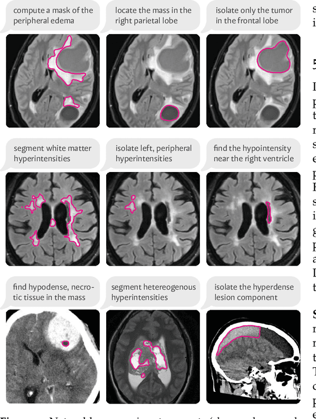 Figure 4 for VoxelPrompt: A Vision-Language Agent for Grounded Medical Image Analysis