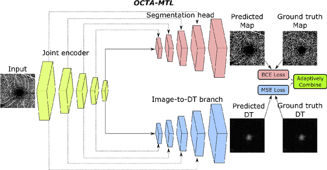 Figure 1 for Multi-task Learning for Optical Coherence Tomography Angiography (OCTA) Vessel Segmentation