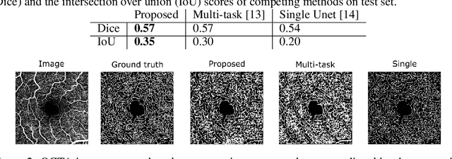 Figure 2 for Multi-task Learning for Optical Coherence Tomography Angiography (OCTA) Vessel Segmentation