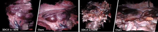 Figure 1 for Free-SurGS: SfM-Free 3D Gaussian Splatting for Surgical Scene Reconstruction