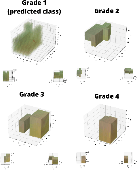 Figure 3 for Stop overkilling simple tasks with black-box models and use transparent models instead