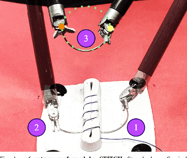 Figure 1 for STITCH: Augmented Dexterity for Suture Throws Including Thread Coordination and Handoffs