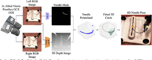 Figure 2 for STITCH: Augmented Dexterity for Suture Throws Including Thread Coordination and Handoffs