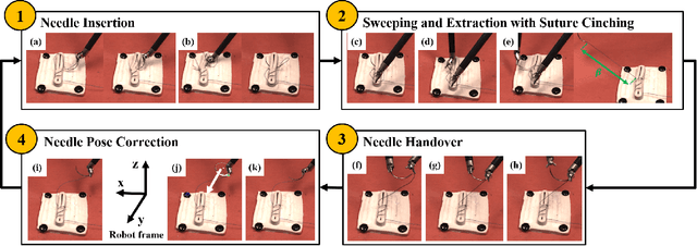 Figure 3 for STITCH: Augmented Dexterity for Suture Throws Including Thread Coordination and Handoffs