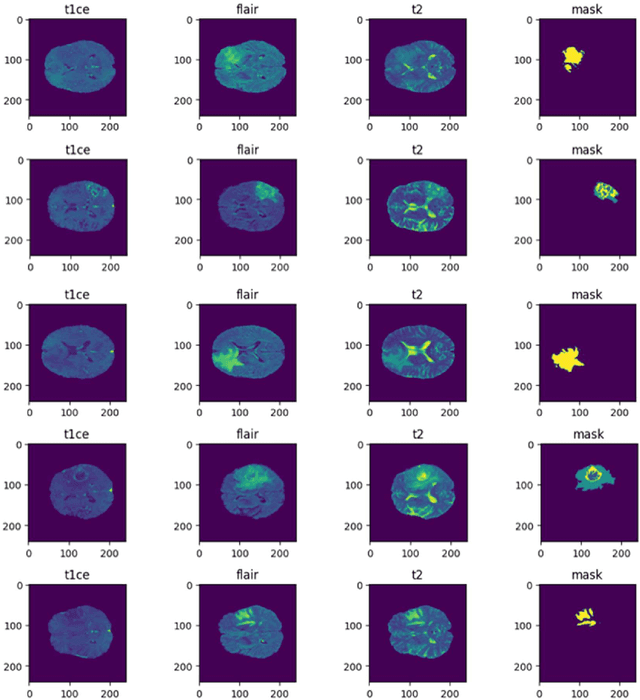 Figure 1 for An Integrated Deep Learning Framework for Effective Brain Tumor Localization, Segmentation, and Classification from Magnetic Resonance Images