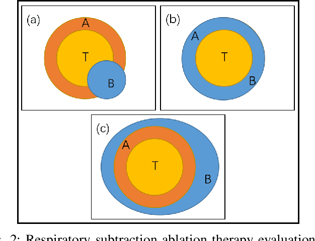 Figure 2 for Respiratory Subtraction for Pulmonary Microwave Ablation Evaluation