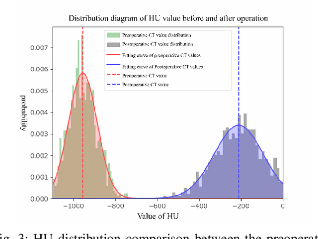 Figure 3 for Respiratory Subtraction for Pulmonary Microwave Ablation Evaluation