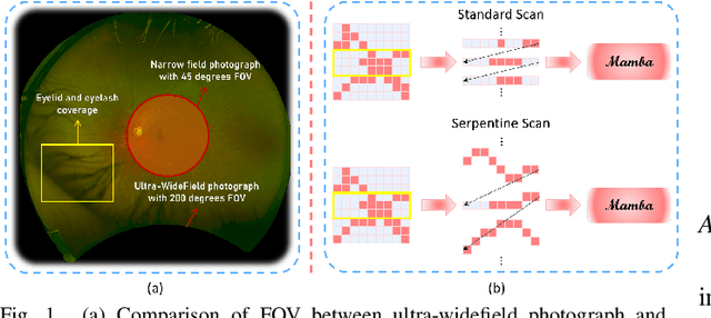 Figure 1 for Serp-Mamba: Advancing High-Resolution Retinal Vessel Segmentation with Selective State-Space Model