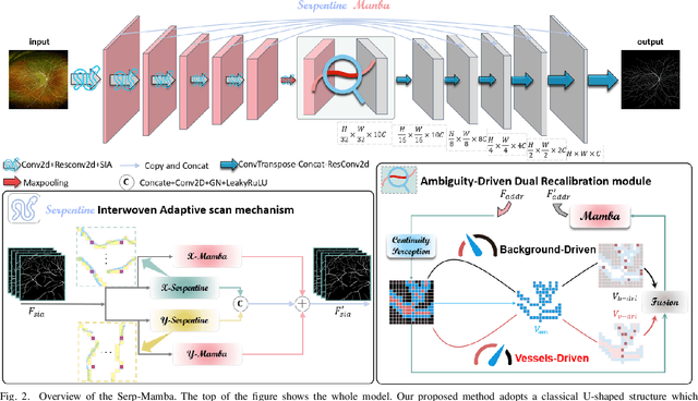 Figure 2 for Serp-Mamba: Advancing High-Resolution Retinal Vessel Segmentation with Selective State-Space Model