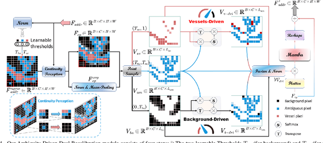 Figure 4 for Serp-Mamba: Advancing High-Resolution Retinal Vessel Segmentation with Selective State-Space Model