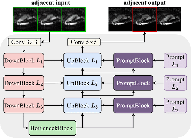 Figure 3 for The state-of-the-art in Cardiac MRI Reconstruction: Results of the CMRxRecon Challenge in MICCAI 2023