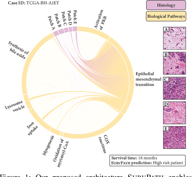 Figure 1 for Modeling Dense Multimodal Interactions Between Biological Pathways and Histology for Survival Prediction