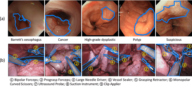 Figure 1 for Rethinking Exemplars for Continual Semantic Segmentation in Endoscopy Scenes: Entropy-based Mini-Batch Pseudo-Replay