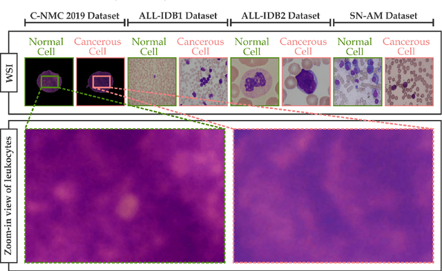 Figure 1 for CoTCoNet: An Optimized Coupled Transformer-Convolutional Network with an Adaptive Graph Reconstruction for Leukemia Detection