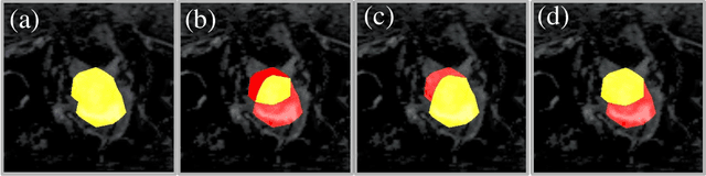 Figure 3 for Exploring Weakly Supervised Semantic Segmentation Ensembles for Medical Imaging Systems