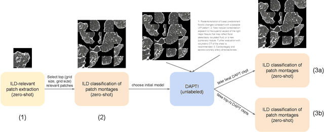 Figure 3 for Exploring the Versatility of Zero-Shot CLIP for Interstitial Lung Disease Classification