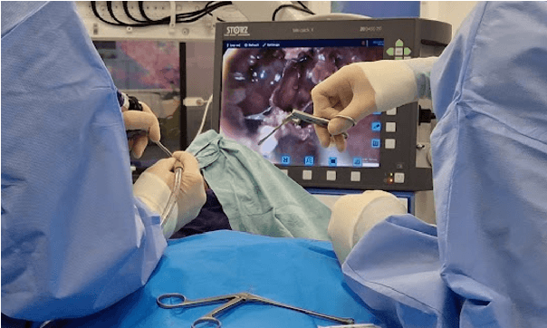 Figure 3 for PitVis-2023 Challenge: Workflow Recognition in videos of Endoscopic Pituitary Surgery