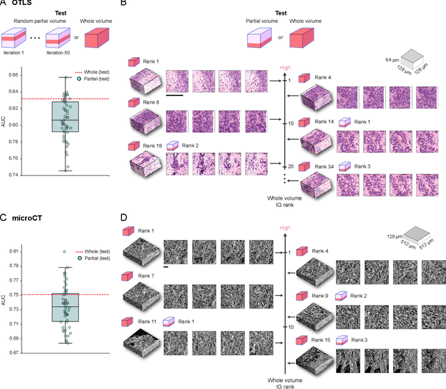 Figure 4 for Weakly Supervised AI for Efficient Analysis of 3D Pathology Samples