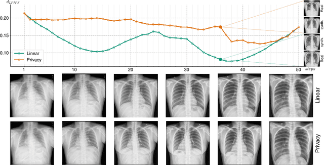 Figure 3 for A Privacy-Preserving Walk in the Latent Space of Generative Models for Medical Applications