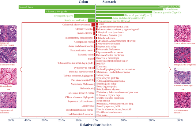 Figure 1 for AI-based Anomaly Detection for Clinical-Grade Histopathological Diagnostics