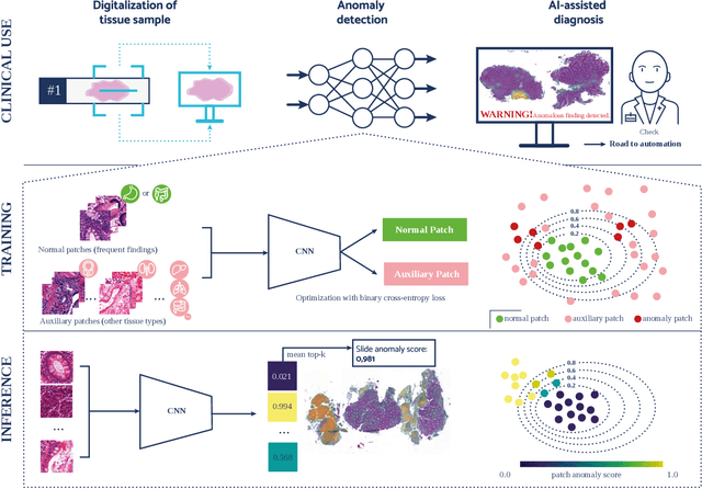 Figure 3 for AI-based Anomaly Detection for Clinical-Grade Histopathological Diagnostics