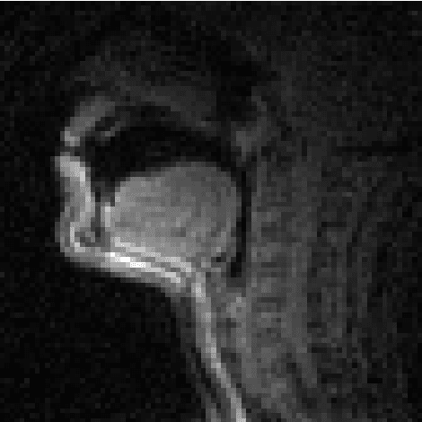 Figure 1 for Deep Speech Synthesis from MRI-Based Articulatory Representations