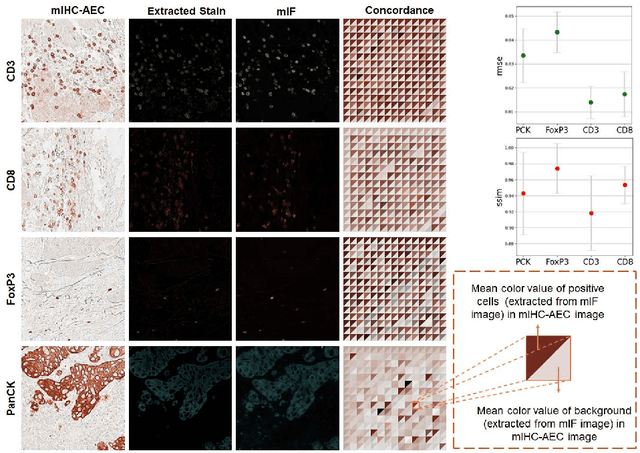 Figure 4 for An AI-Ready Multiplex Staining Dataset for Reproducible and Accurate Characterization of Tumor Immune Microenvironment