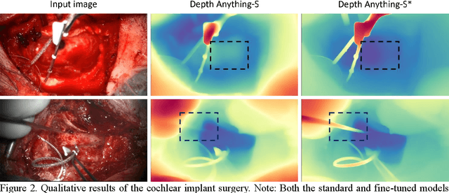 Figure 3 for Surgical Depth Anything: Depth Estimation for Surgical Scenes using Foundation Models