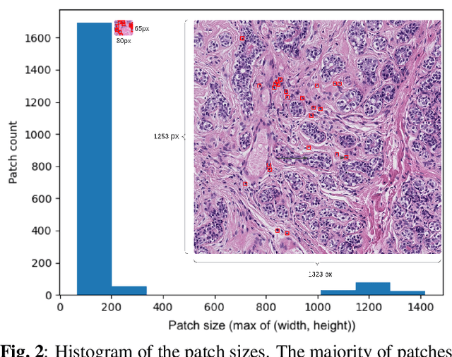 Figure 3 for Optimizing Lymphocyte Detection in Breast Cancer Whole Slide Imaging through Data-Centric Strategies