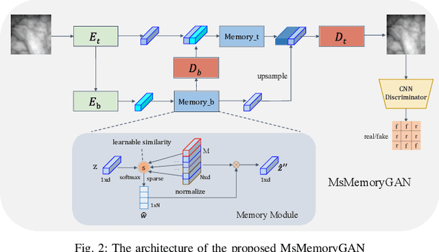 Figure 3 for MsMemoryGAN: A Multi-scale Memory GAN for Palm-vein Adversarial Purification