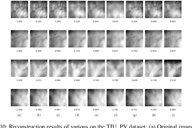 Figure 2 for MsMemoryGAN: A Multi-scale Memory GAN for Palm-vein Adversarial Purification