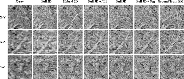 Figure 3 for X-Ray2EM: Uncertainty-Aware Cross-Modality Image Reconstruction from X-Ray to Electron Microscopy in Connectomics