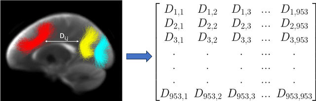 Figure 3 for White Matter Geometry-Guided Score-Based Diffusion Model for Tissue Microstructure Imputation in Tractography Imaging