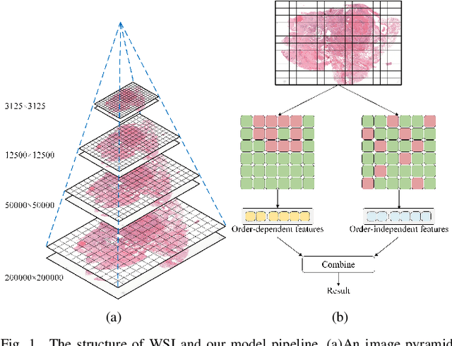 Figure 1 for Mamba2MIL: State Space Duality Based Multiple Instance Learning for Computational Pathology