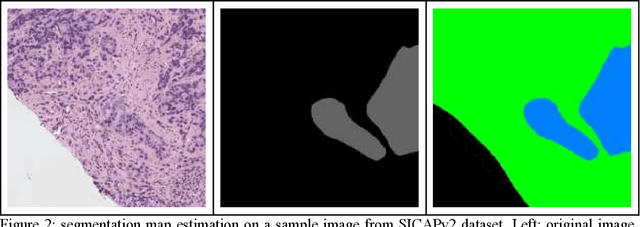 Figure 3 for Segmentation Strategies in Deep Learning for Prostate Cancer Diagnosis: A Comparative Study of Mamba, SAM, and YOLO