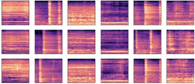 Figure 3 for Improved Techniques for the Conditional Generative Augmentation of Clinical Audio Data