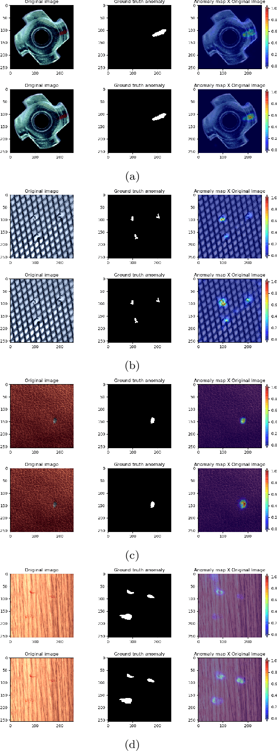 Figure 3 for Unified Anomaly Detection methods on Edge Device using Knowledge Distillation and Quantization