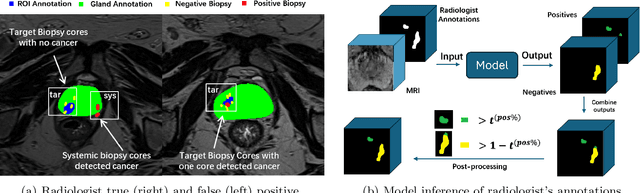 Figure 3 for AI-assisted prostate cancer detection and localisation on biparametric MR by classifying radiologist-positives