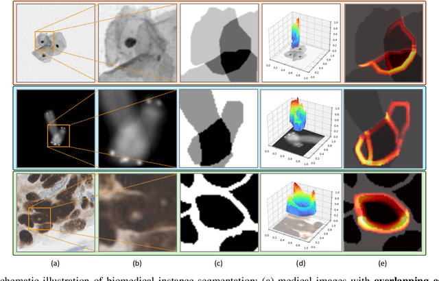 Figure 1 for GAInS: Gradient Anomaly-aware Biomedical Instance Segmentation