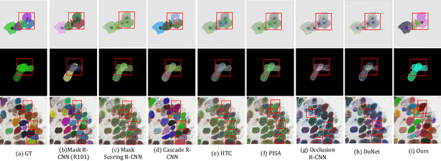 Figure 4 for GAInS: Gradient Anomaly-aware Biomedical Instance Segmentation