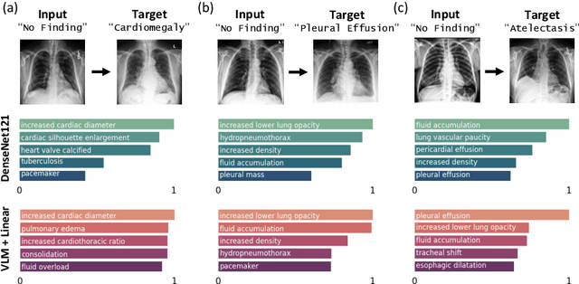 Figure 3 for Explaining Chest X-ray Pathology Models using Textual Concepts