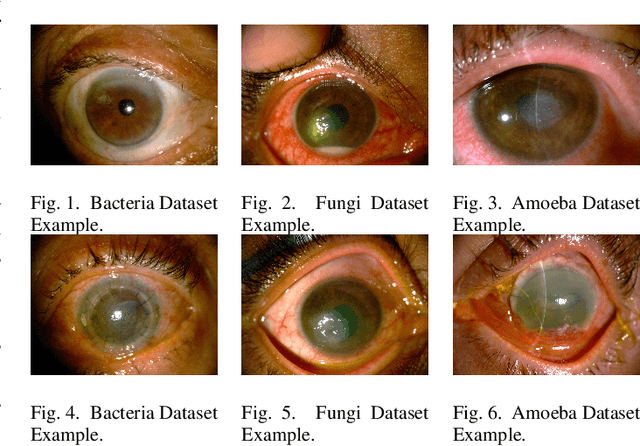 Figure 1 for Classification of Keratitis from Eye Corneal Photographs using Deep Learning