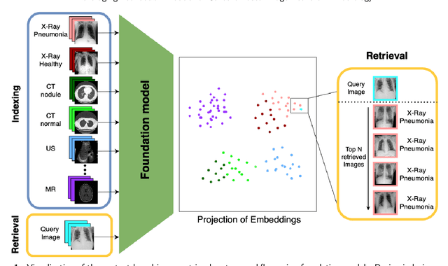 Figure 1 for Leveraging Foundation Models for Content-Based Medical Image Retrieval in Radiology