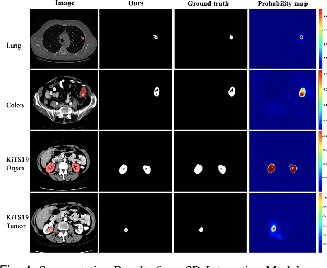 Figure 4 for Lightweight Method for Interactive 3D Medical Image Segmentation with Multi-Round Result Fusion