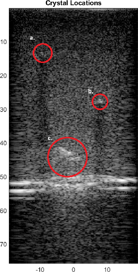 Figure 2 for A Radiological Clip Design Using Ultrasound Identification to Improve Localization