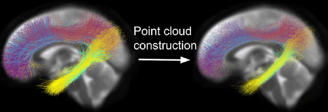 Figure 1 for TractShapeNet: Efficient Multi-Shape Learning with 3D Tractography Point Clouds