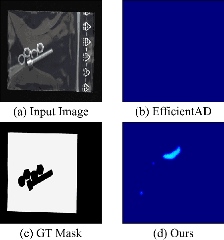 Figure 1 for Separating Novel Features for Logical Anomaly Detection: A Straightforward yet Effective Approach