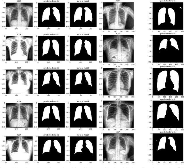 Figure 2 for Medical Image Analysis for Detection, Treatment and Planning of Disease using Artificial Intelligence Approaches